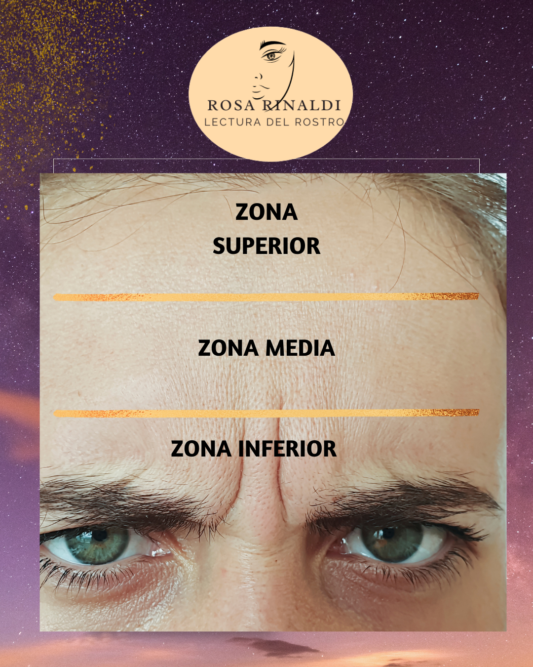 Zonas de la Frente
